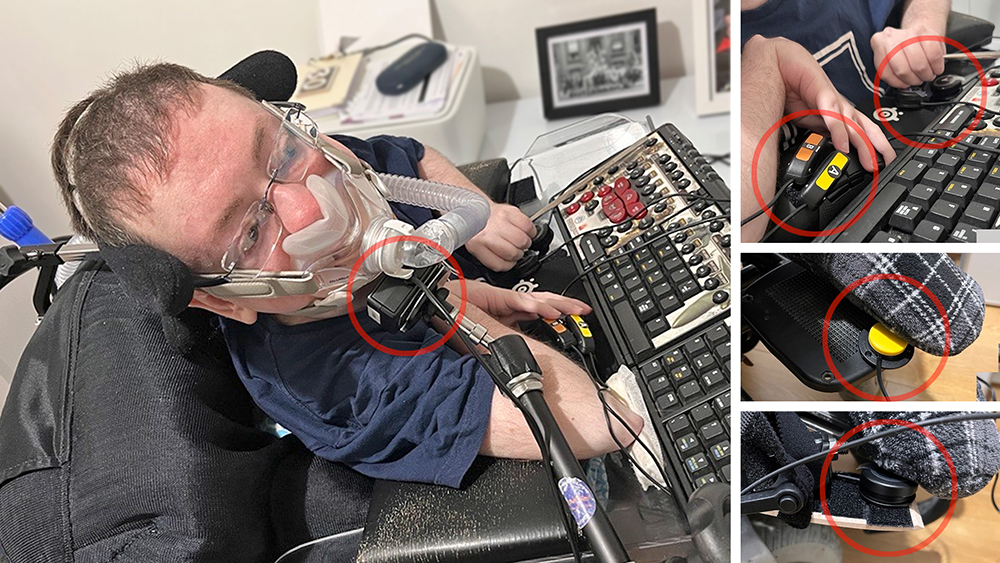 Man in wheelchair with ventilator using a chin joystick and assistive button switches with his fingers and feet